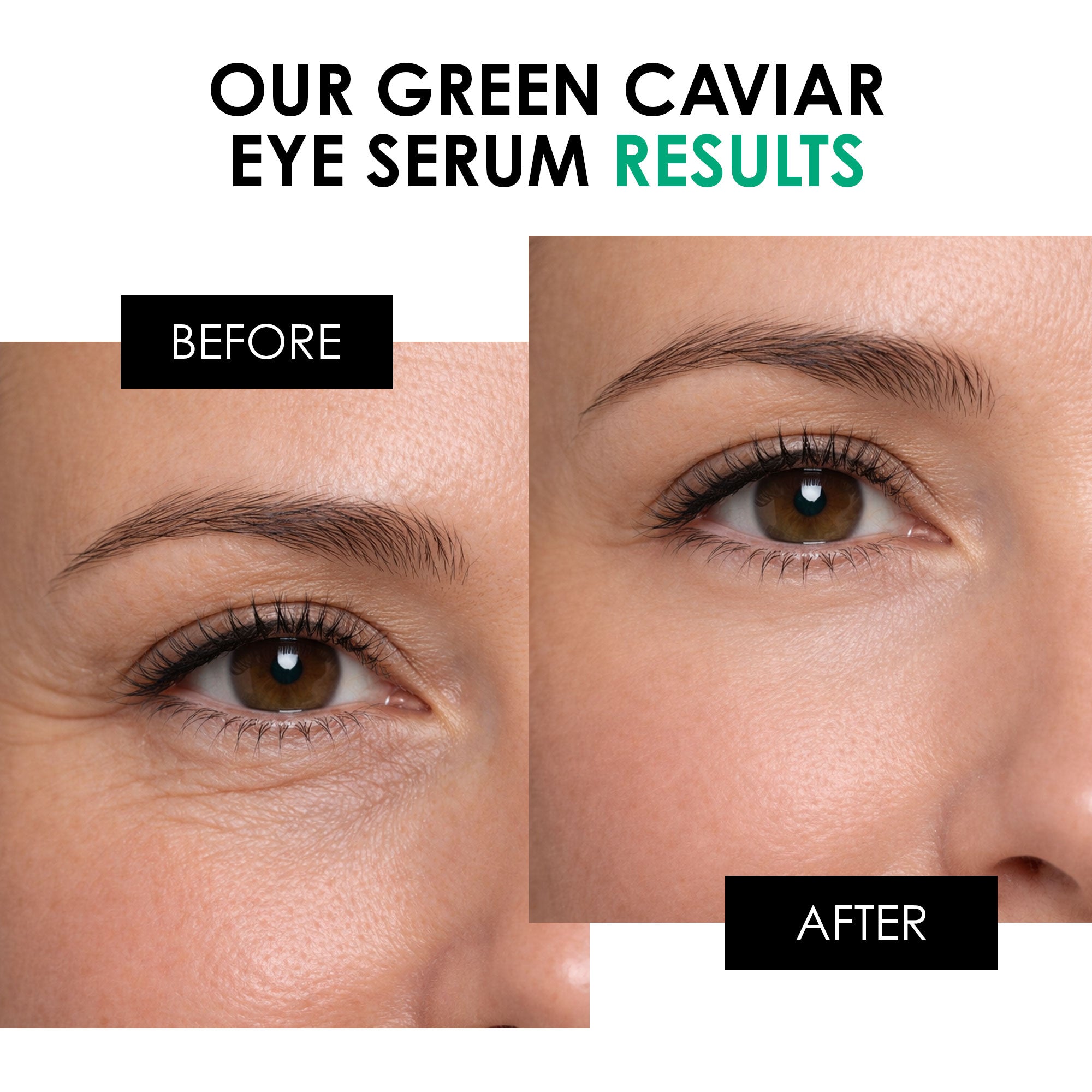 Youth Series Green Caviar Eye Serum 15ml