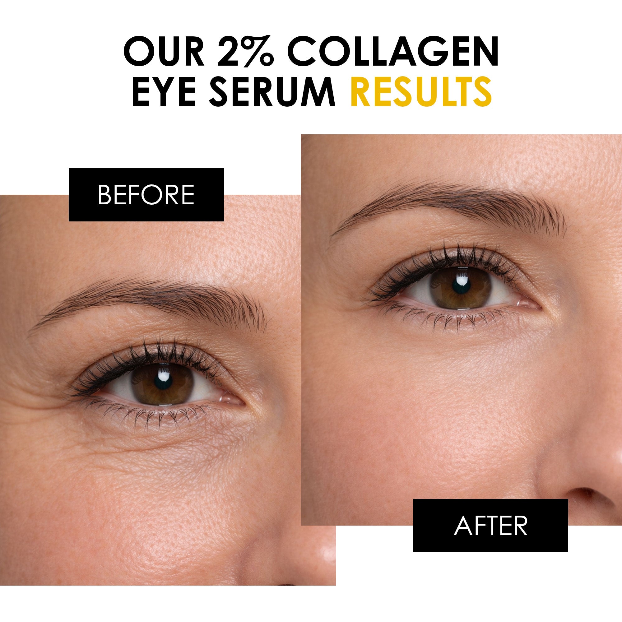 Youth Series 2% Collagen Augenserum 15ml
