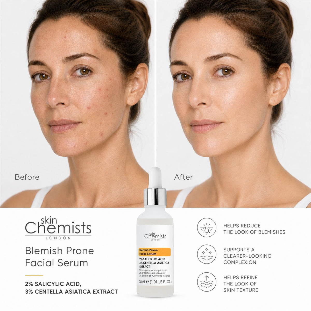 Gesichtsserum für zu Unreinheiten neigende Haut mit 2 % Salicylsäure und 3 % Centella asiatica 30ml