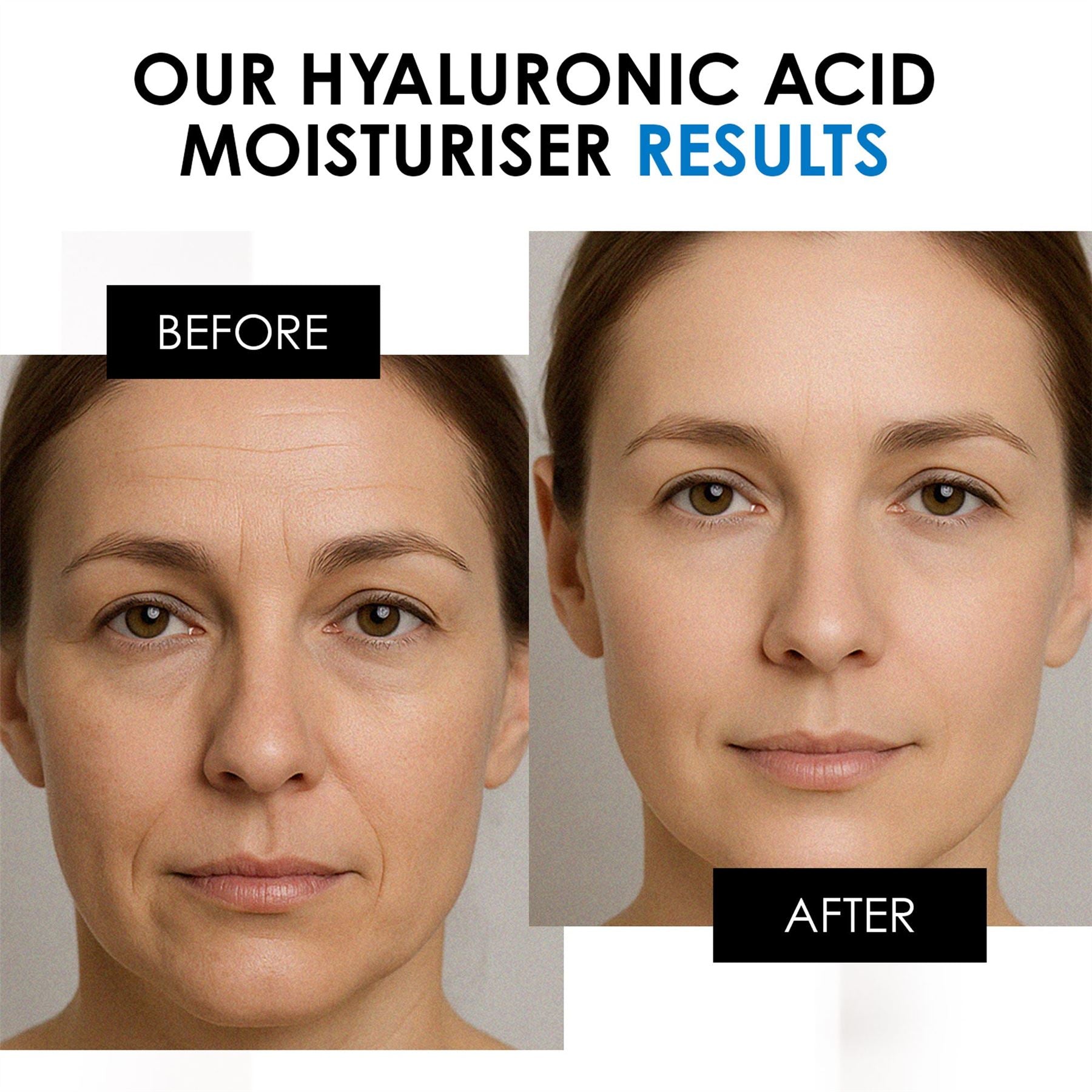 skinChemists Hyaluronsäure Tagescreme 50ml