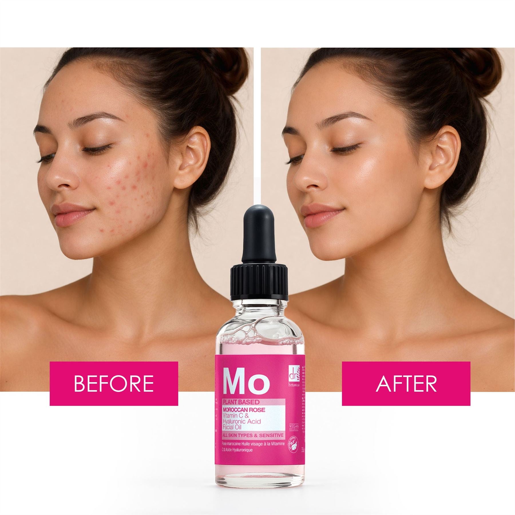 Marokkanisches Rosen-Gesichtsöl mit Hyaluronsäure und Vitamin C, 30 ml
